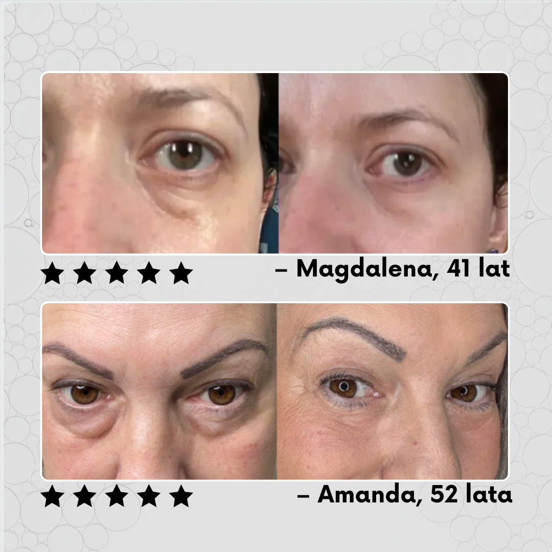 Revira™ Siła kofeiny - Serum pod oczy